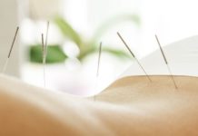 Acupuncture for Weight Loss: Does It Work?