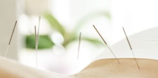 Acupuncture for Weight Loss: Does It Work?