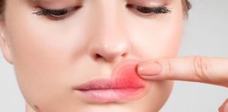 How to Get Rid of a Cold Sore—and Prevent It From Coming Back